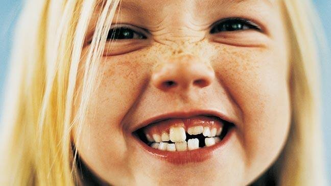 girl-brushing-teeth-136393757006703901-141015160438