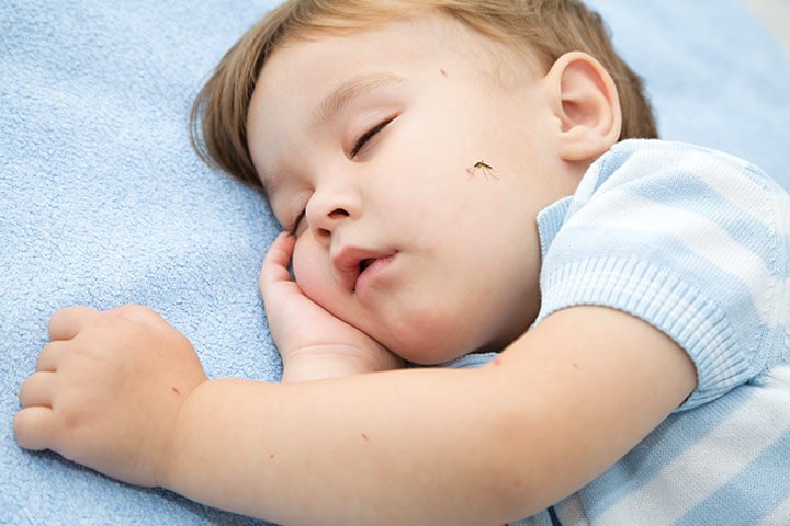 Mosquito-Bites-In-Toddlers
